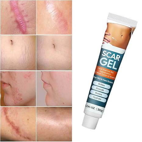 Silicone Scar Removal Gel