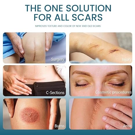 Silicone Scar Removal Gel